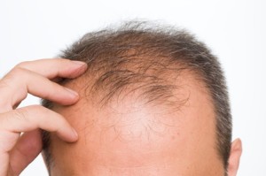 Is This Contributing To Your Hair Loss?